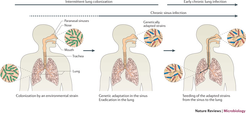 Bacterial Phylum: Proteobacteria - Pace University ePortfolio